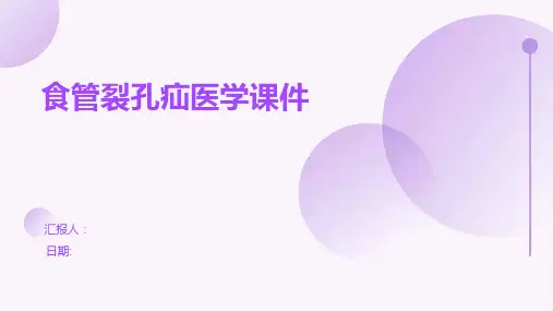 食管裂孔疝医学课件