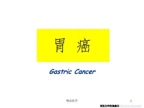 《胃部肿瘤》PPT课件
