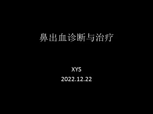 鼻出血诊断与治疗