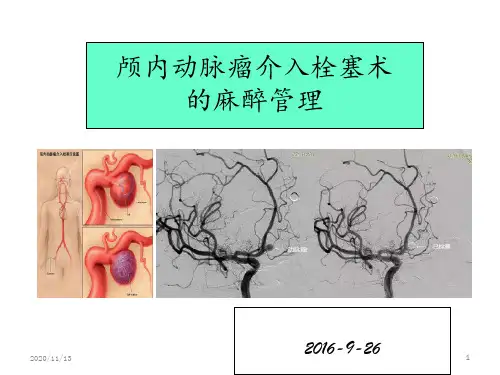 颅内动脉瘤介入栓塞术的麻醉管理1 ppt课件