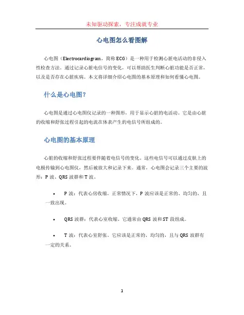 心电图怎么看图解