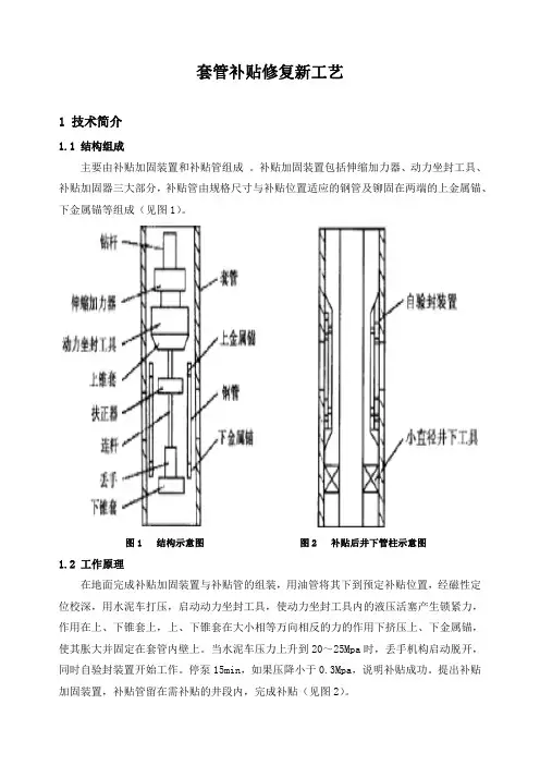 石油工程技术   井下作业    套管补贴修复新工艺