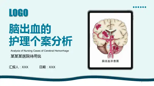 脑出血个案护理分析PPT