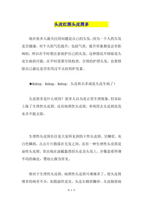 头皮红斑头皮屑多