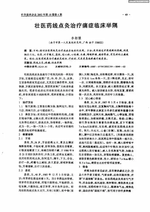 壮医药线点灸治疗痛症临床举隅