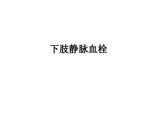 下肢血栓PPT课件