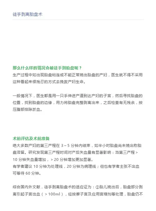 徒手剥离胎盘术