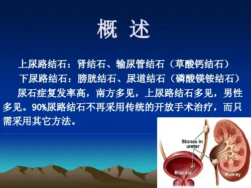 泌尿系结石讲义ppt