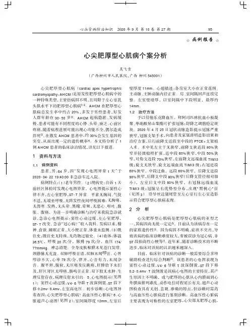 心尖肥厚型心肌病个案分析