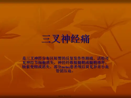 医学专题三叉神经痛特发性面神经麻痹GBS指南22812