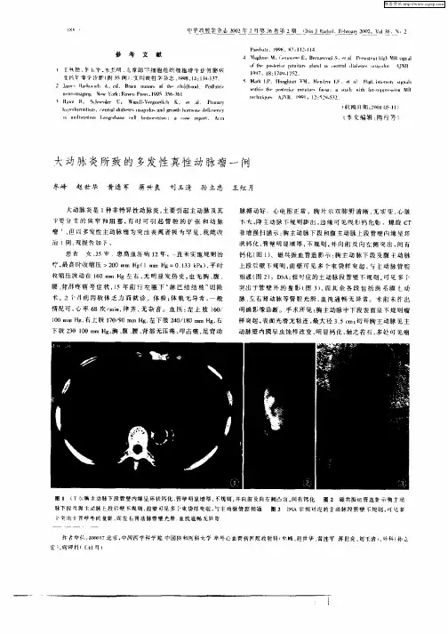 大动脉炎所致的多发性真性动脉瘤一例