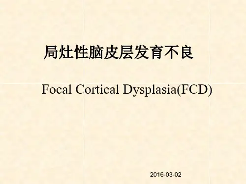 局灶性脑皮层发育不良