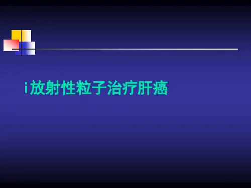 i放射性粒子治疗肝癌