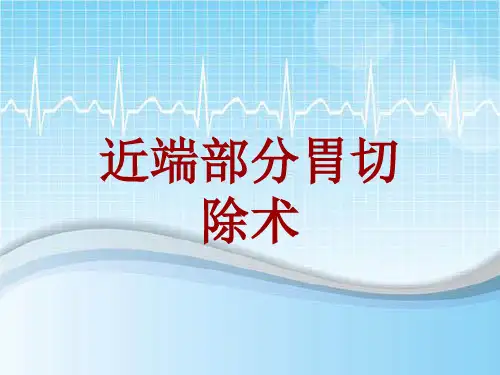 手术讲解模板：近端部分胃切除术