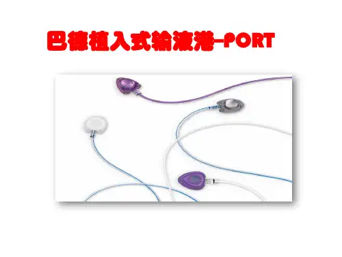 输液港介绍(edit)