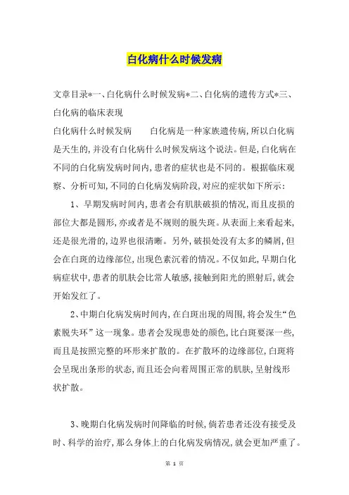 白化病什么时候发病