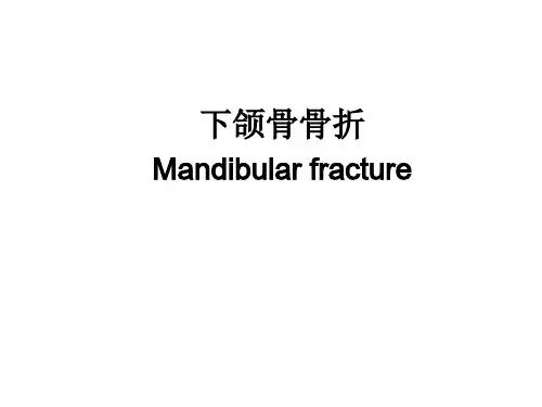 口腔颌面外科学：下颌骨骨折