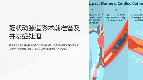 冠状动脉造影术前准备及并发症处理