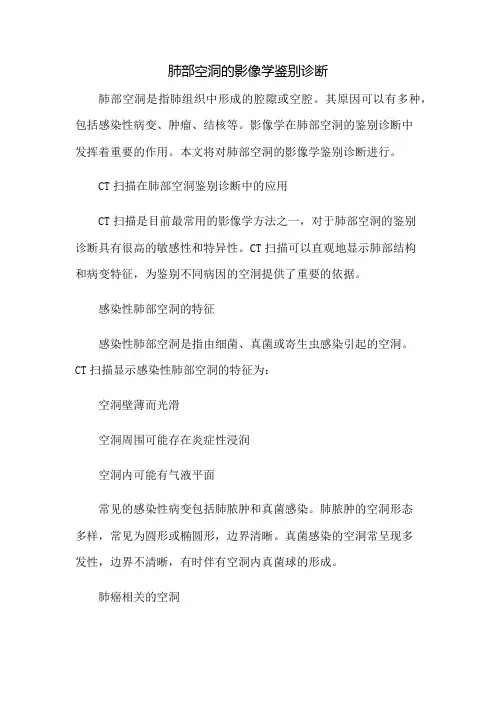 肺部空洞的影像学鉴别诊断总结