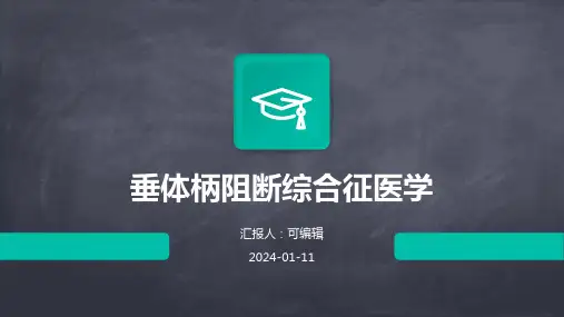 垂体柄阻断综合征医学PPT