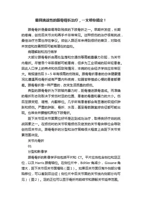 最具挑战性的跟骨骨折治疗，一文帮你搞定！