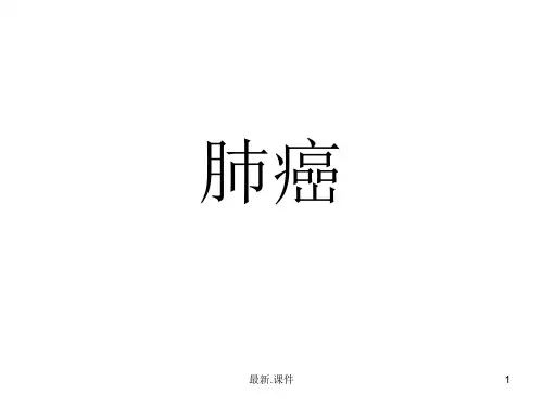 肺癌报告.ppt