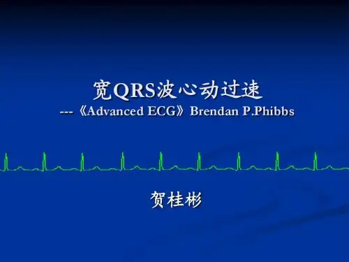 第8讲：宽QRS心动过速鉴别诊断 - 心电图高阶
