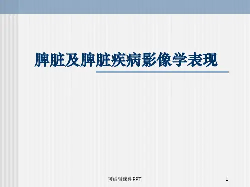 脾脏及脾脏疾病影像学表现PPT课件