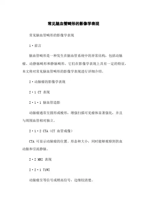 常见脑血管畸形的影像学表现