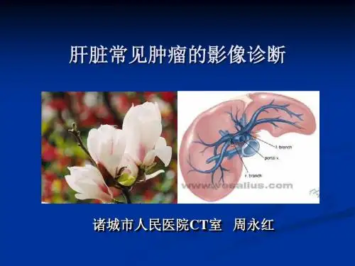 医学-肝脏肿瘤的影像诊断