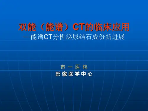 双能CT诊断泌尿系结石三(1)