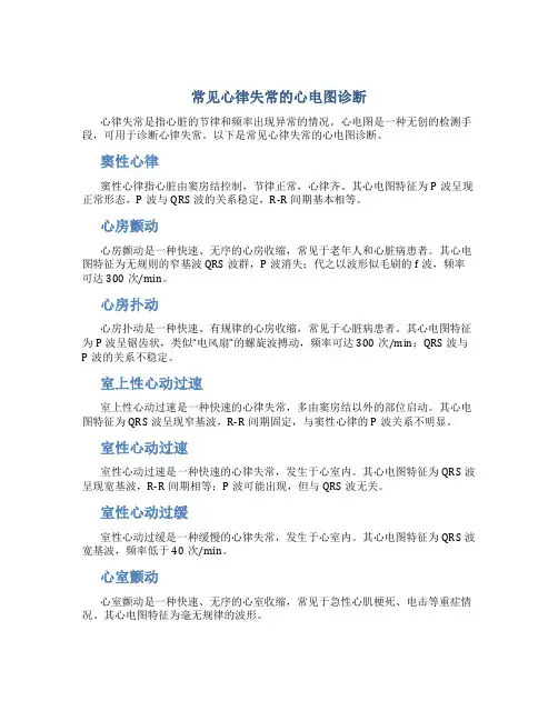 常见心律失常的心电图诊断