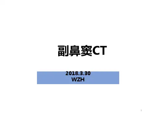 副鼻窦CT参考幻灯片