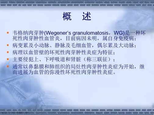 韦格纳肉芽肿(依据卫生部指南完成)