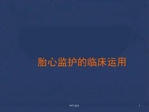 胎心监护的临床运用  ppt课件