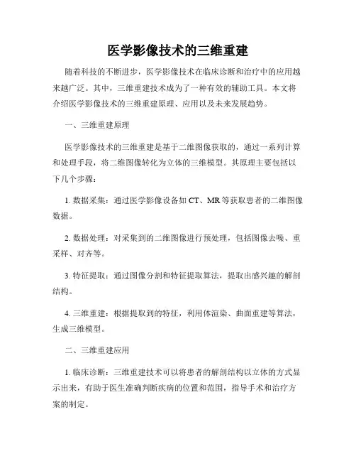 医学影像技术的三维重建