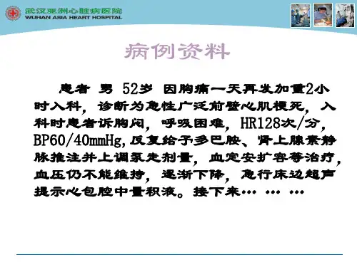 心包穿刺