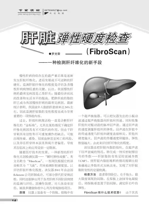 肝脏弹性硬度检查(FibroScan)——一种检测肝纤维化的新手段