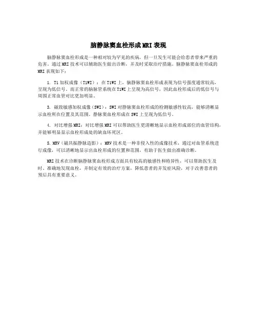脑静脉窦血栓形成MRI表现