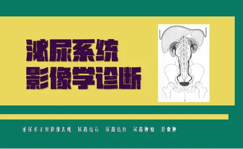 泌尿系统影像诊断