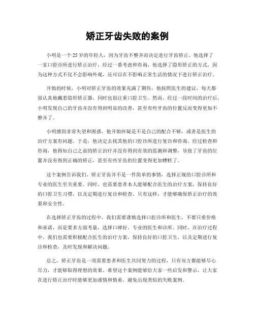矫正牙齿失败的案例
