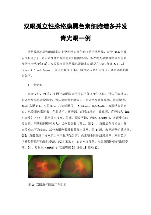 双眼孤立性脉络膜黑色素细胞增多并发青光眼一例