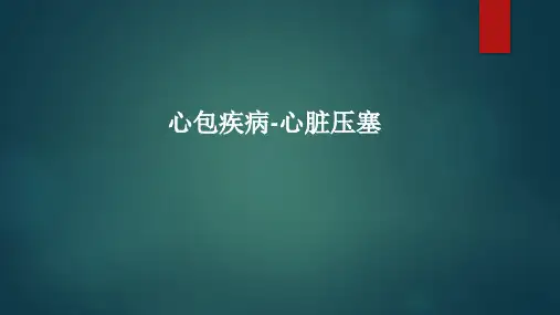 心包疾病-心脏压塞