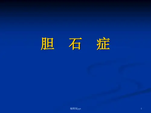 胆石症 ppt课件