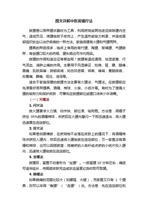 图文详解中医拔罐疗法