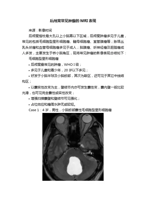 后颅窝常见肿瘤的MRI表现