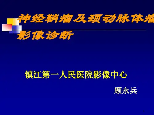 颈动脉体瘤及神经鞘瘤影像诊断PPT参考课件