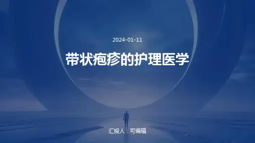 带状疱疹的护理医学PPT