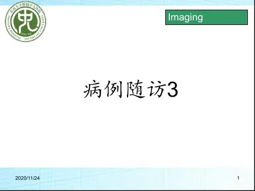 神经纤维瘤病 1 ppt课件