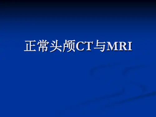 头颅CT和MRI的正常图像课件